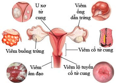 Dùng chung sextoy có thể lây bệnh tình dục?