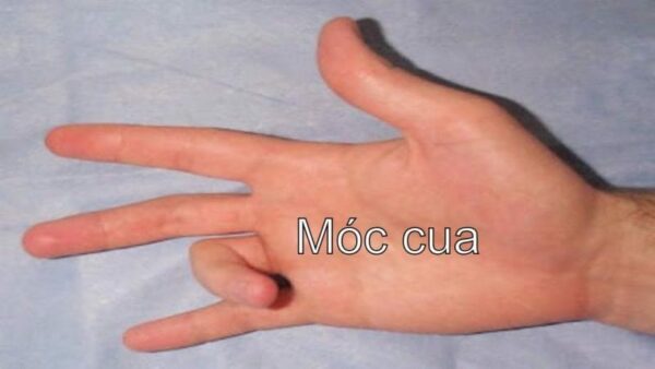 Móc cua