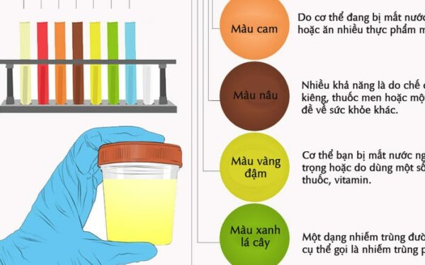 Màu sắc của nước tiểu