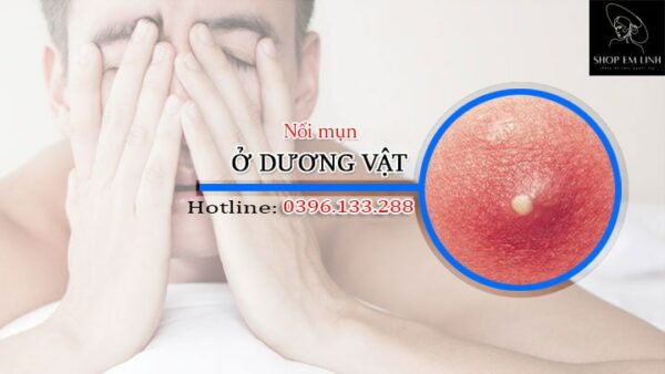 Nổi mụn ở dương vật